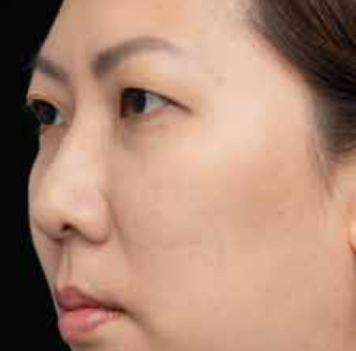 Before/After Image